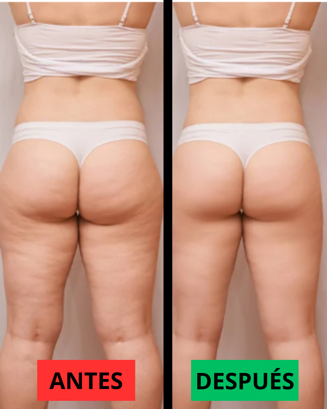 Antes y después — testimonio 3