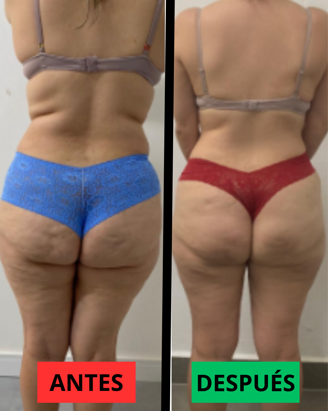 Antes y después — testimonio 2